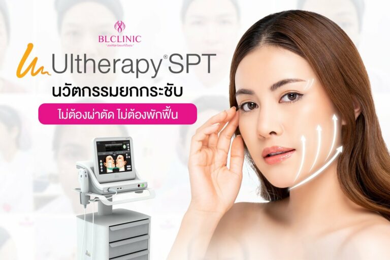 Ultherapy SPT