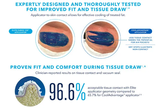 ความแตกต่าง Coolsculpting และ Coolsculpting elite