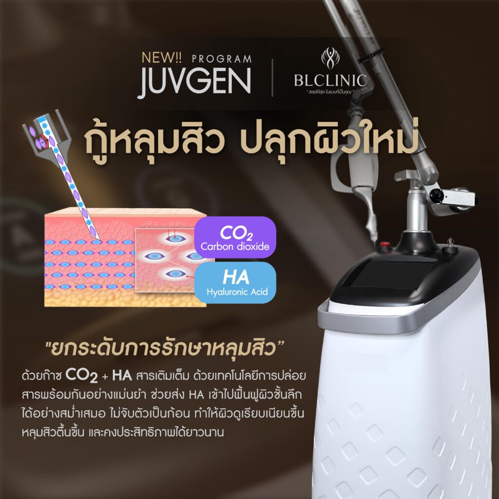 PROGRAM JUVGEN ทำงานยังไง