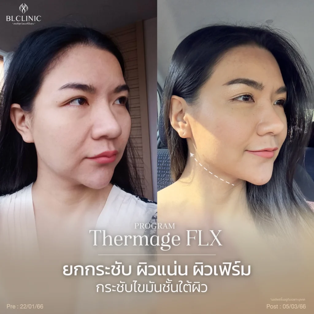 โปรแกรมเทอร์มาจ คือ