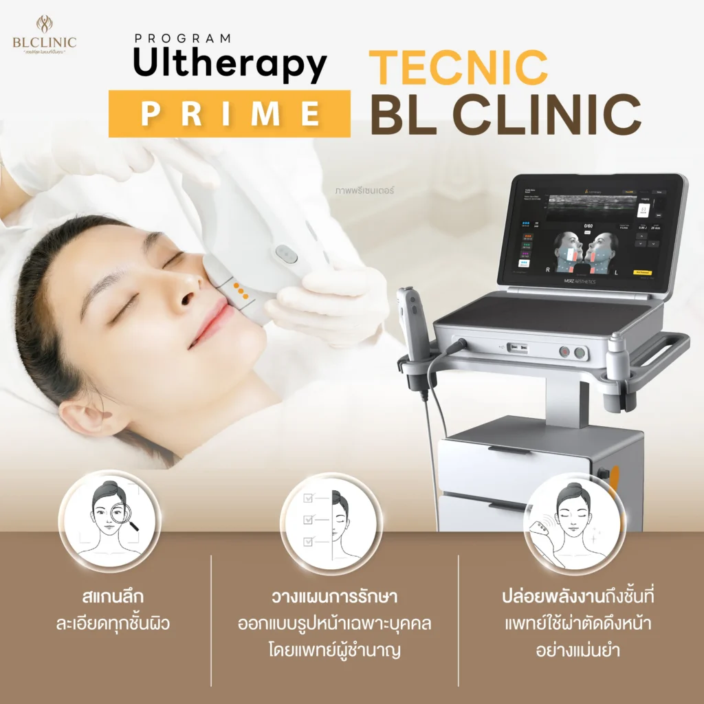 PROGRAM Ultherapy PRIME คือ