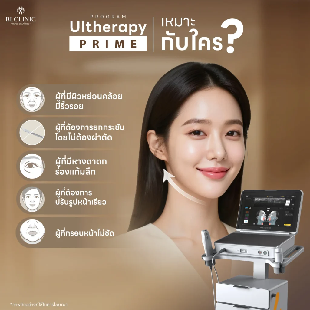 PROGRAM Ultherapy PRIME โคราช เหมาะกับ